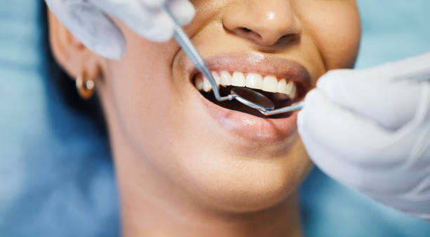 Best Emergency Tooth Extraction in Norwalk, CT