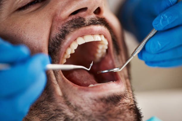 Best Emergency Tooth Extraction in Norwalk, CT