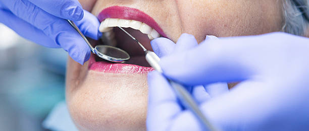 Best Emergency Root Canal Treatment in Norwalk, CT